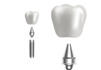 Material e implantes dentales a precio de grupo